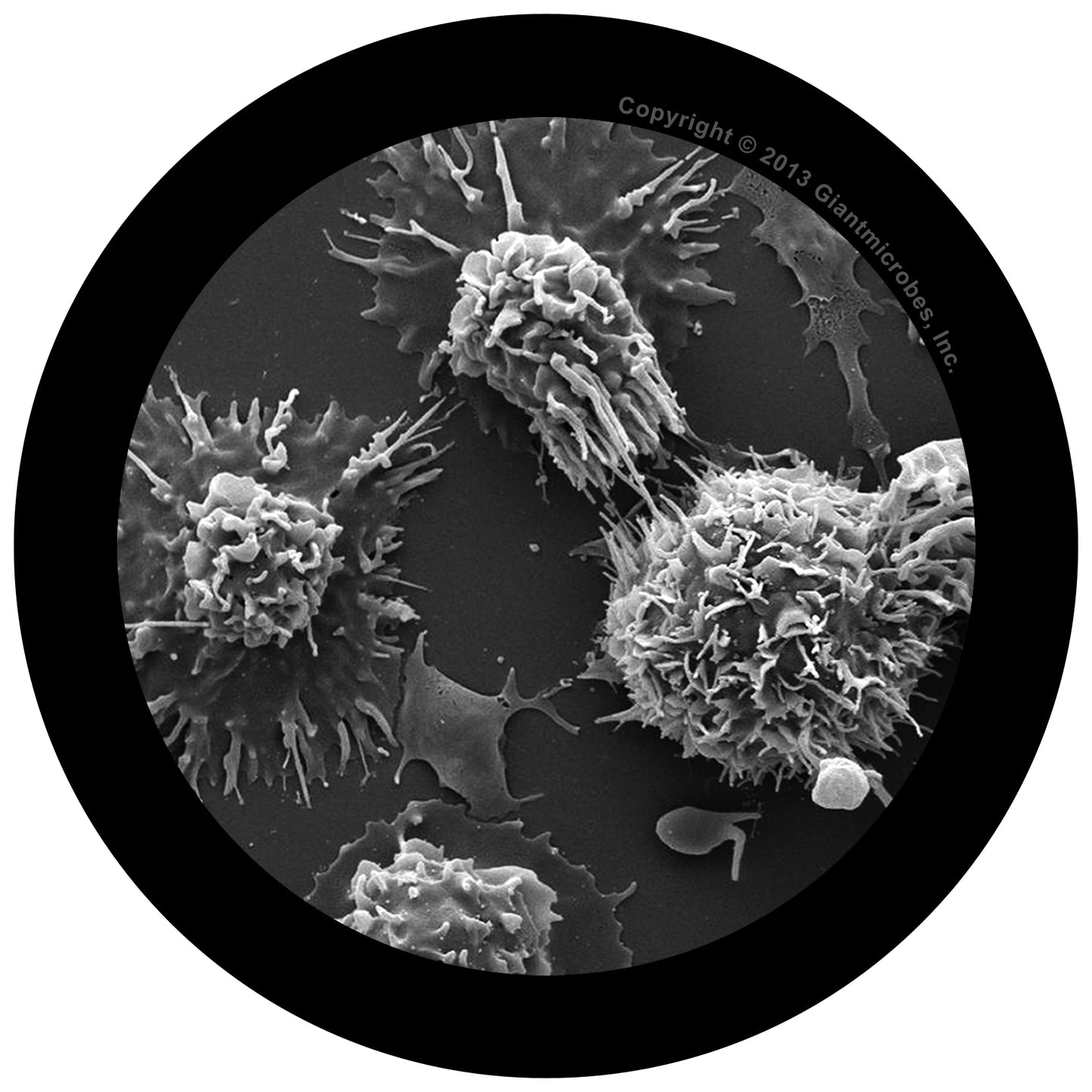 Prostate Cancer (Malignant Neoplasm)