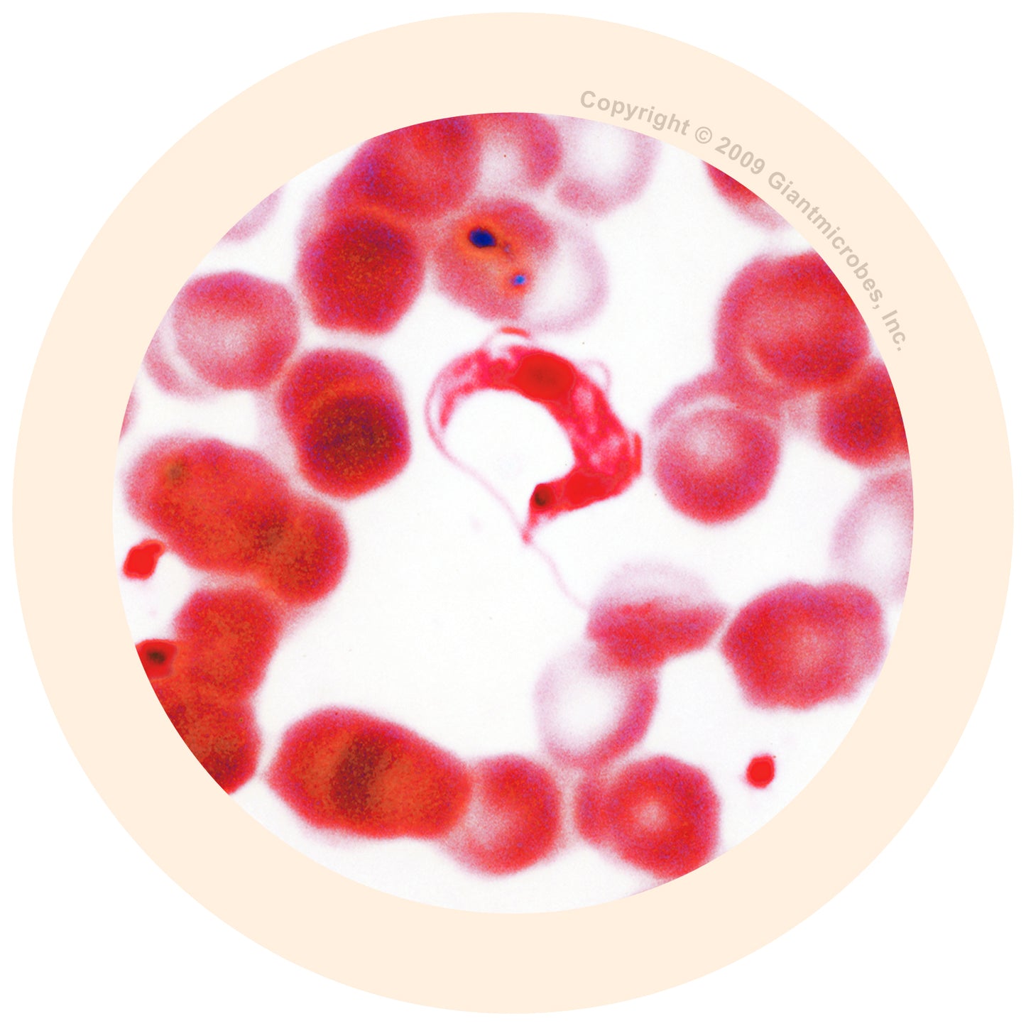 Chagas (Trypanosoma Cruzi)