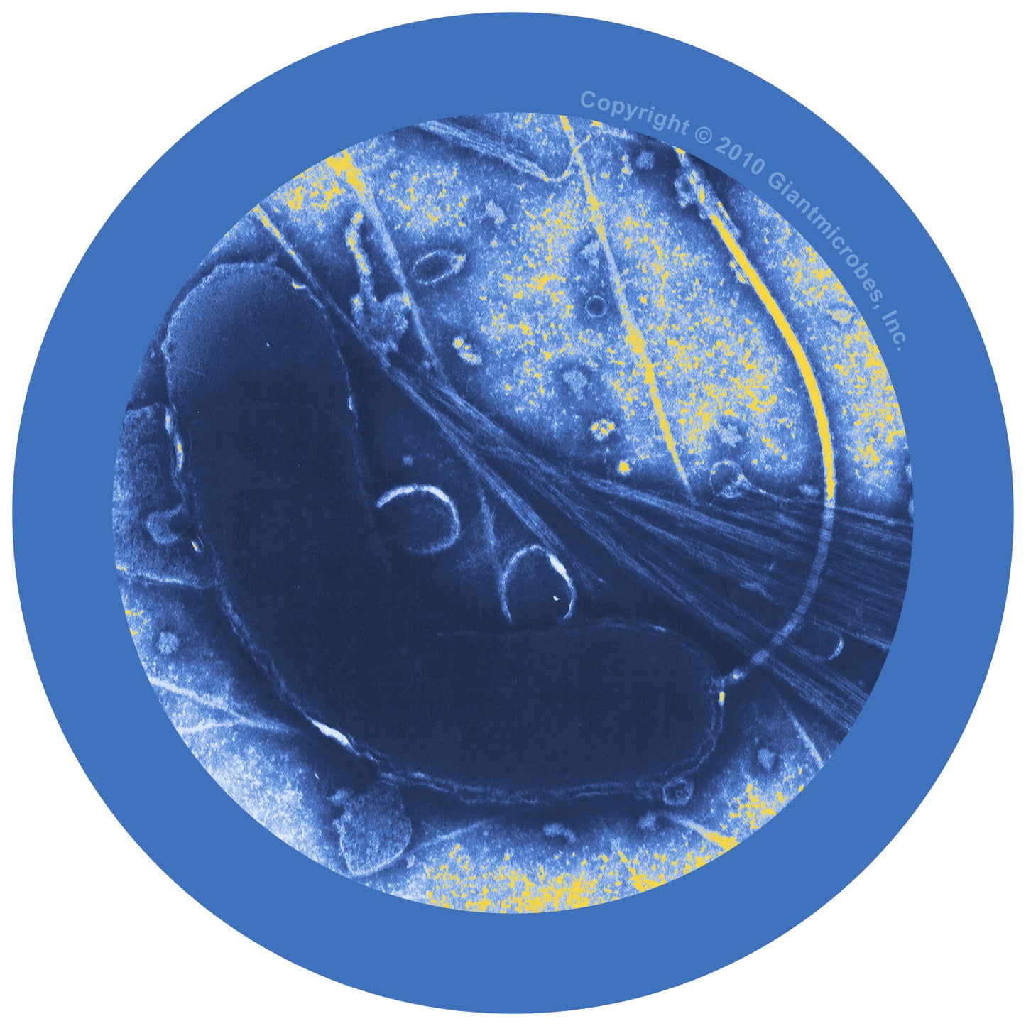 Cholera (Vibrio Cholerae)