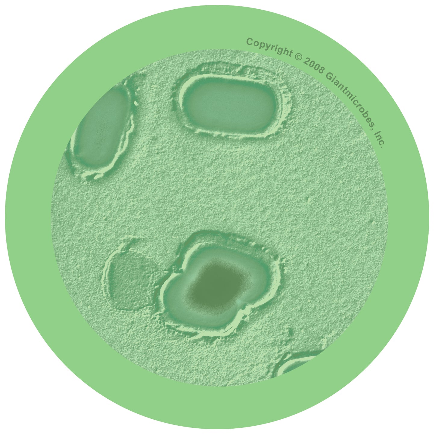Gangrene (Clostridium Perfringens)