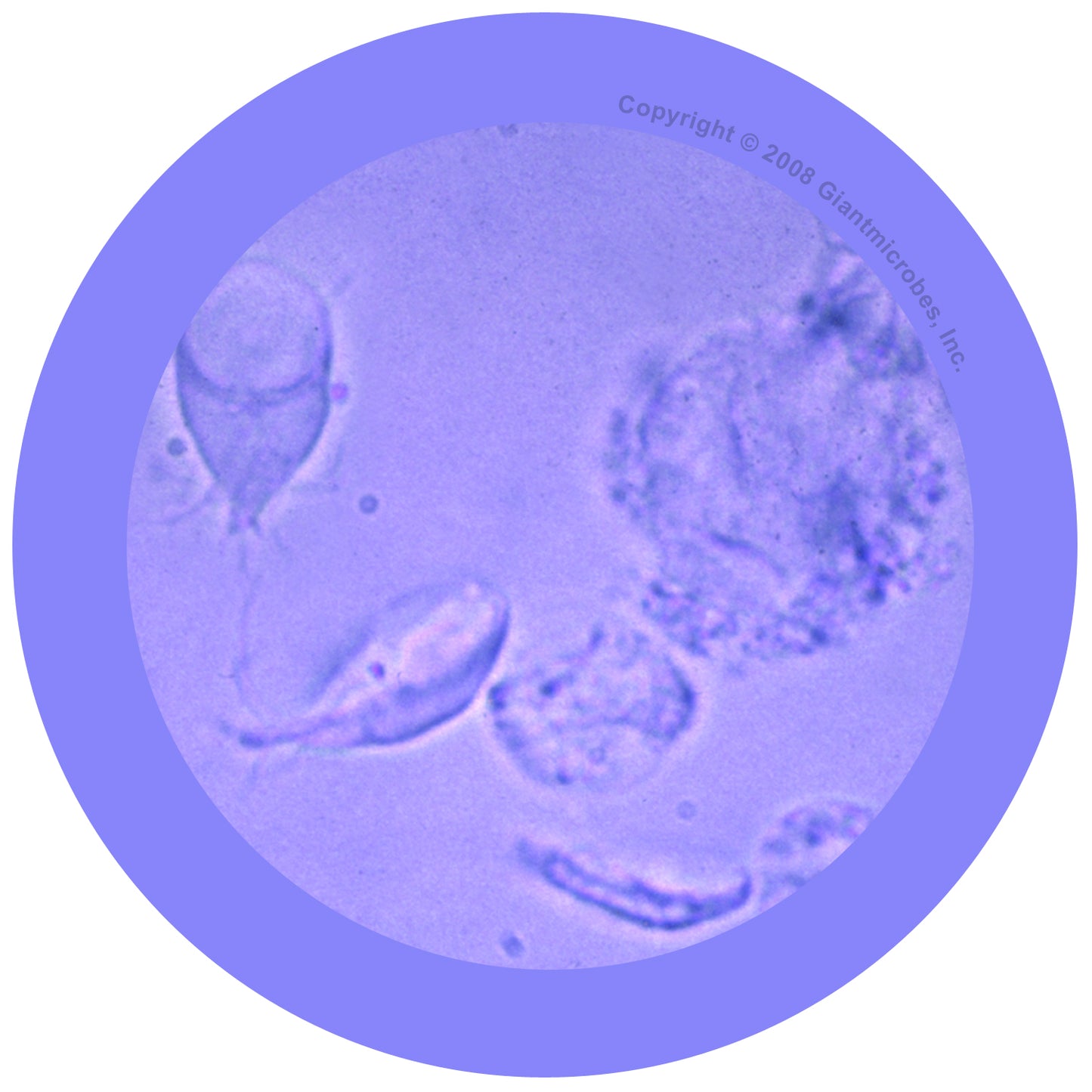Giardia (Giardia Lamblia)