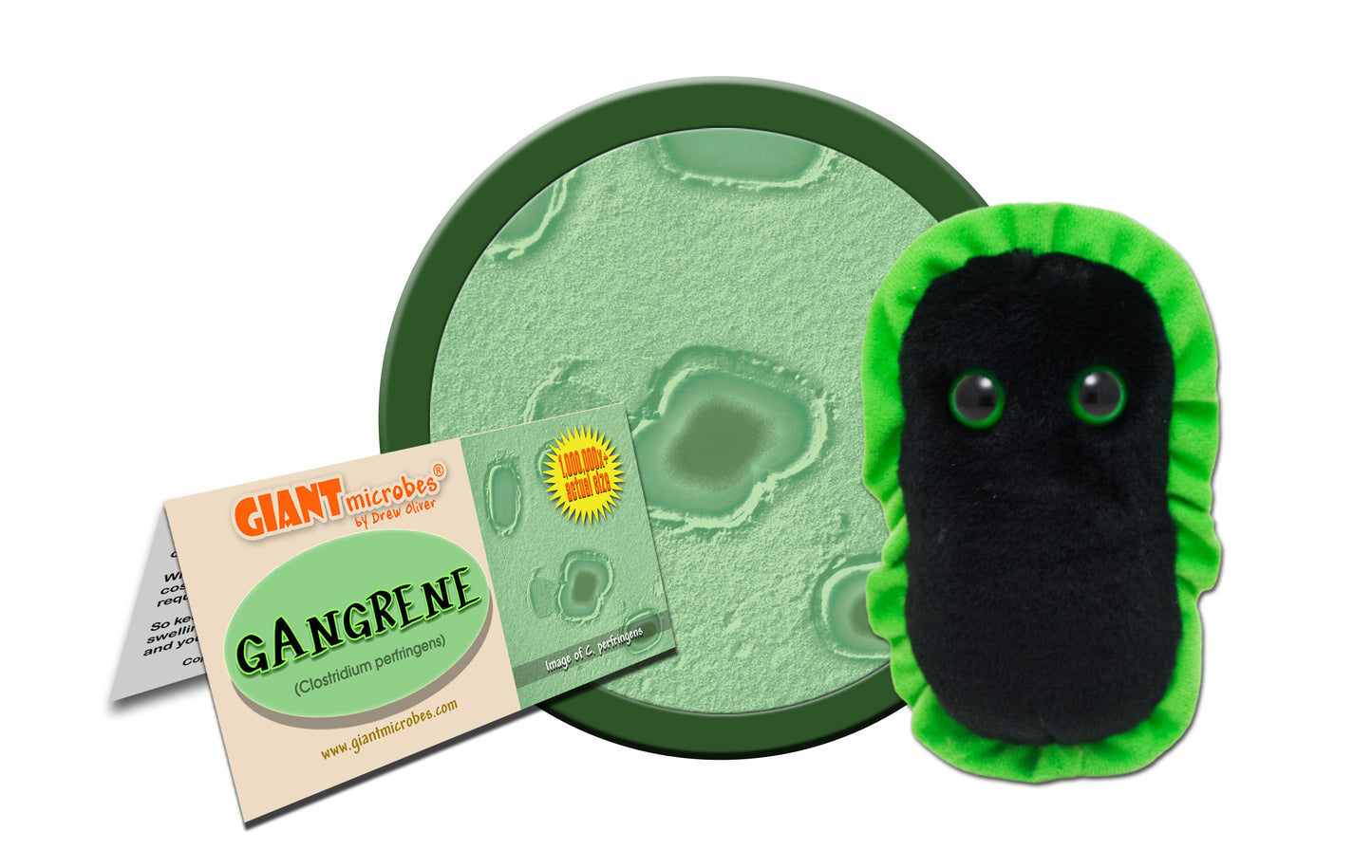 Gangrene (Clostridium Perfringens)