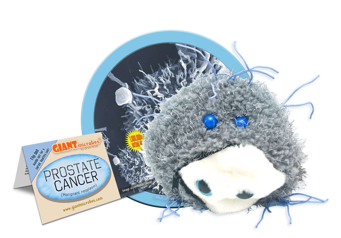 Prostate Cancer (Malignant Neoplasm)