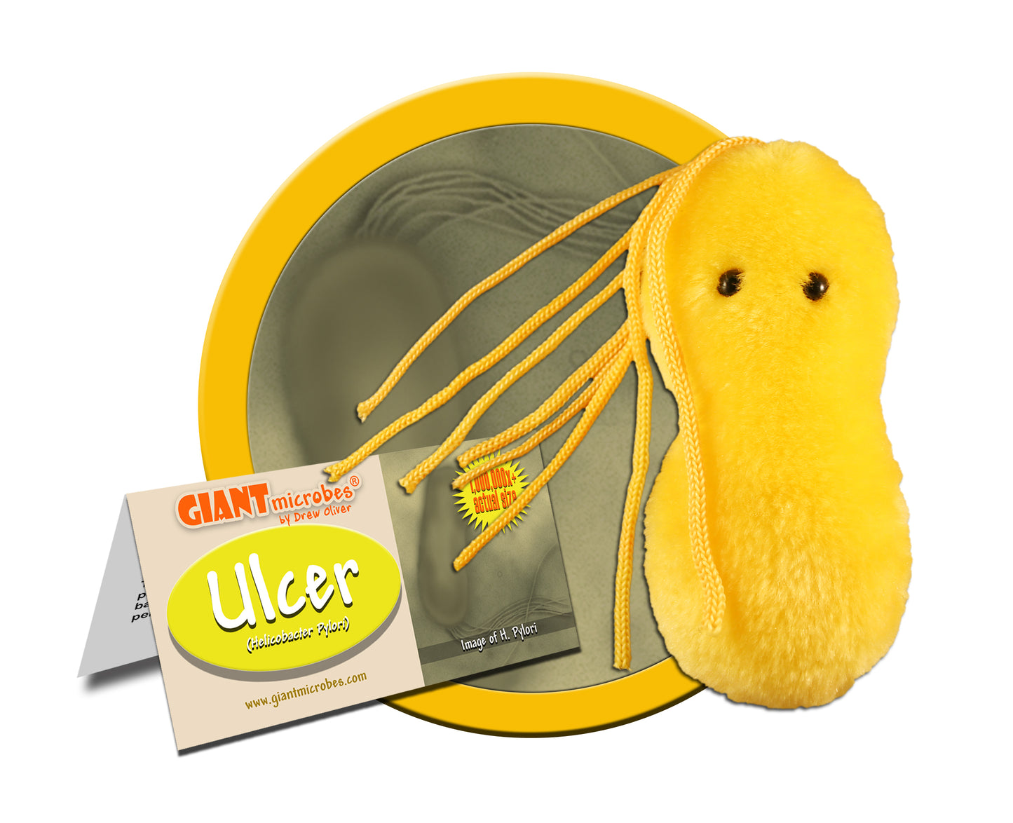 Ulcer (Helicobacter Pylori)