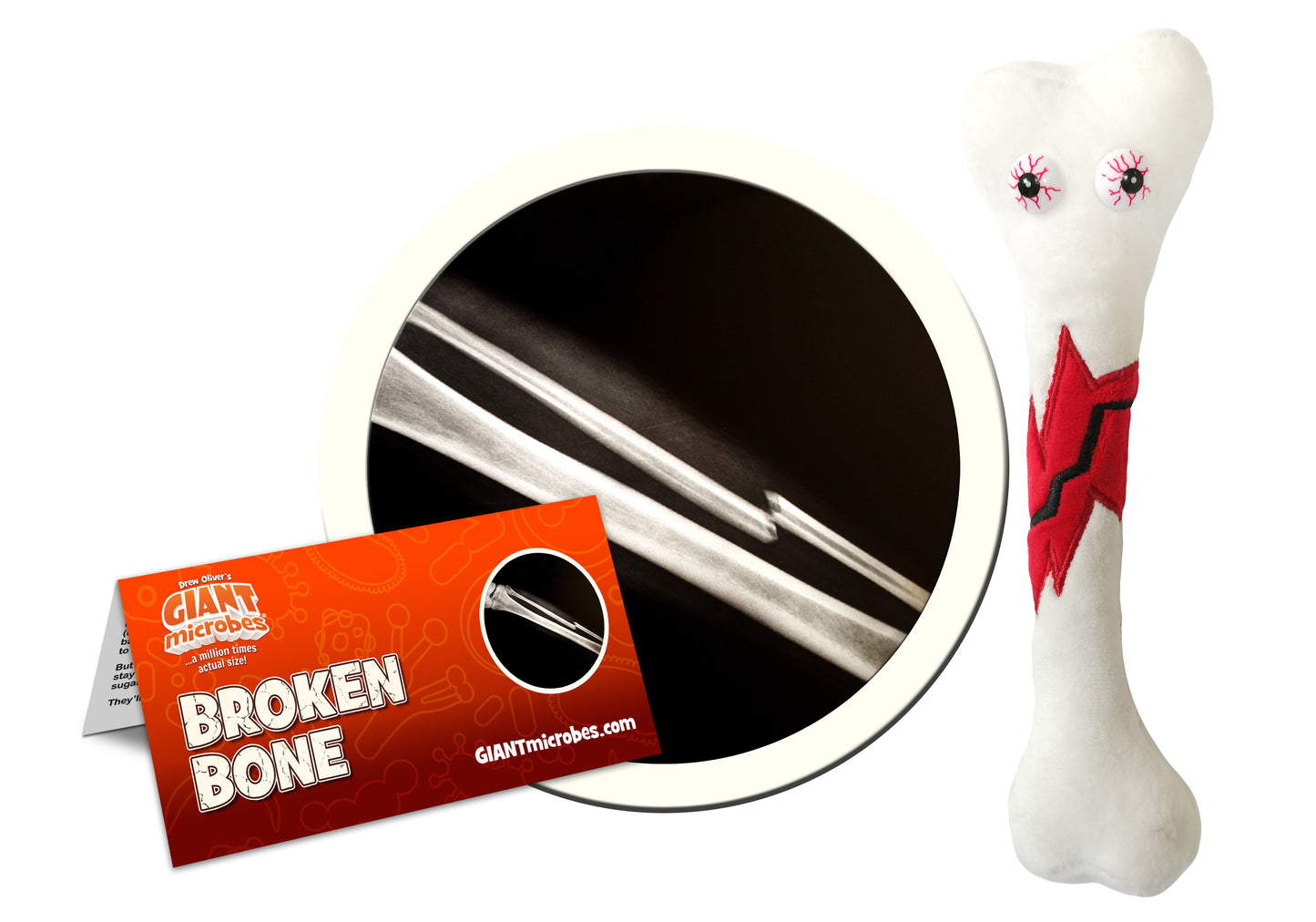 Broken Bone