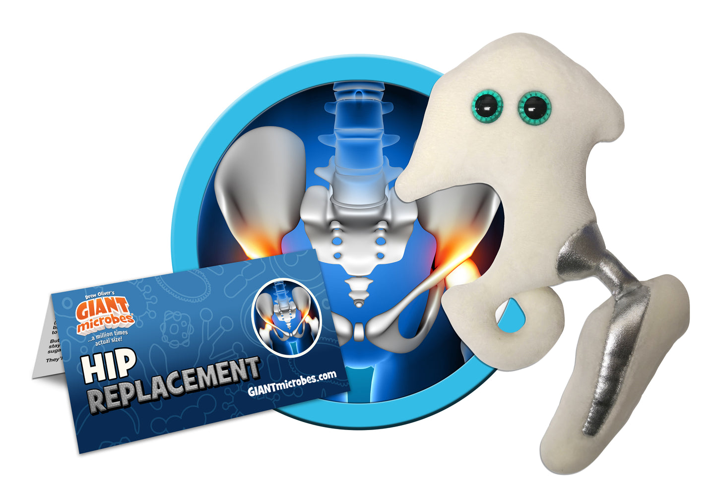 Hip Replacement