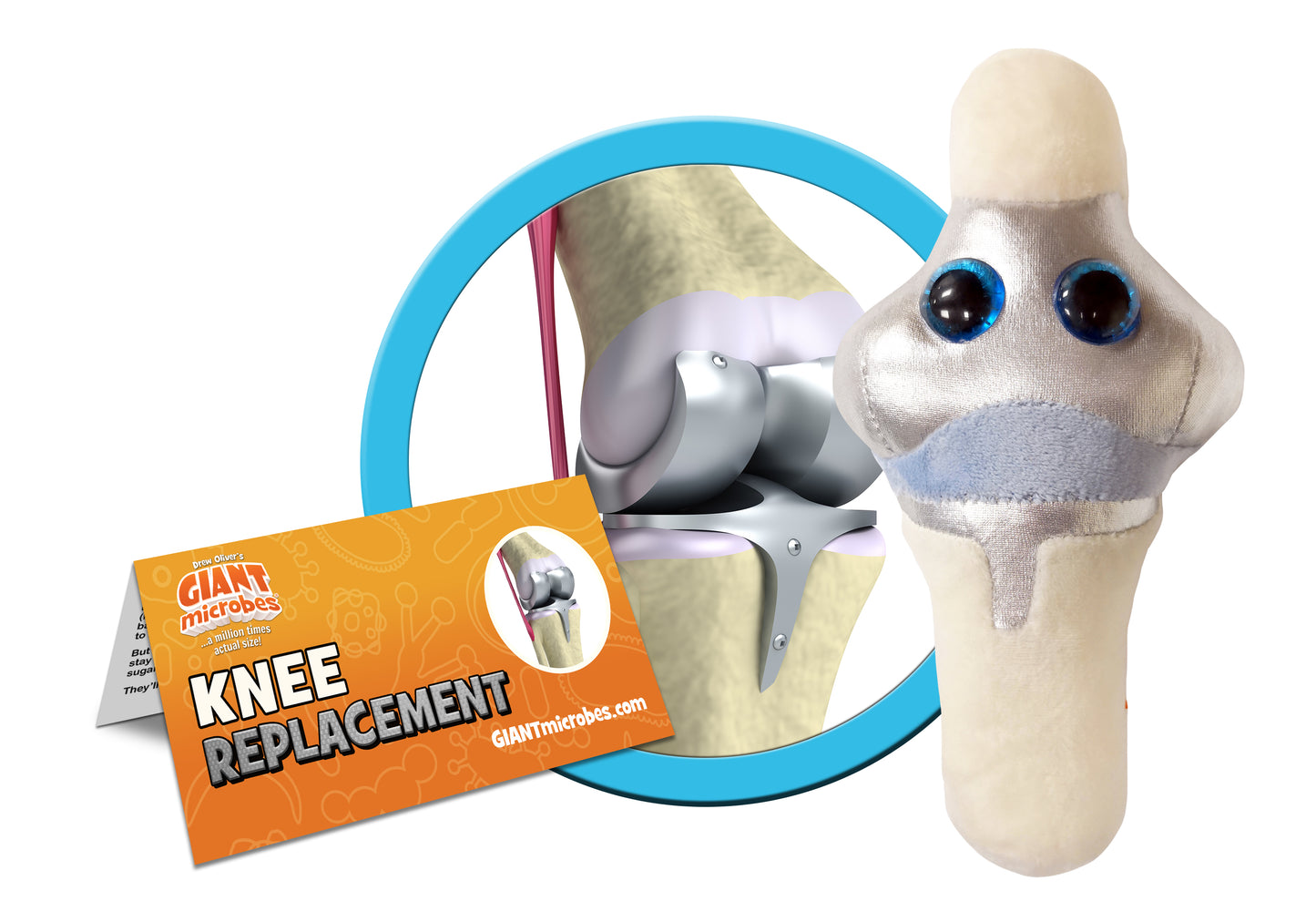 Knee Replacement