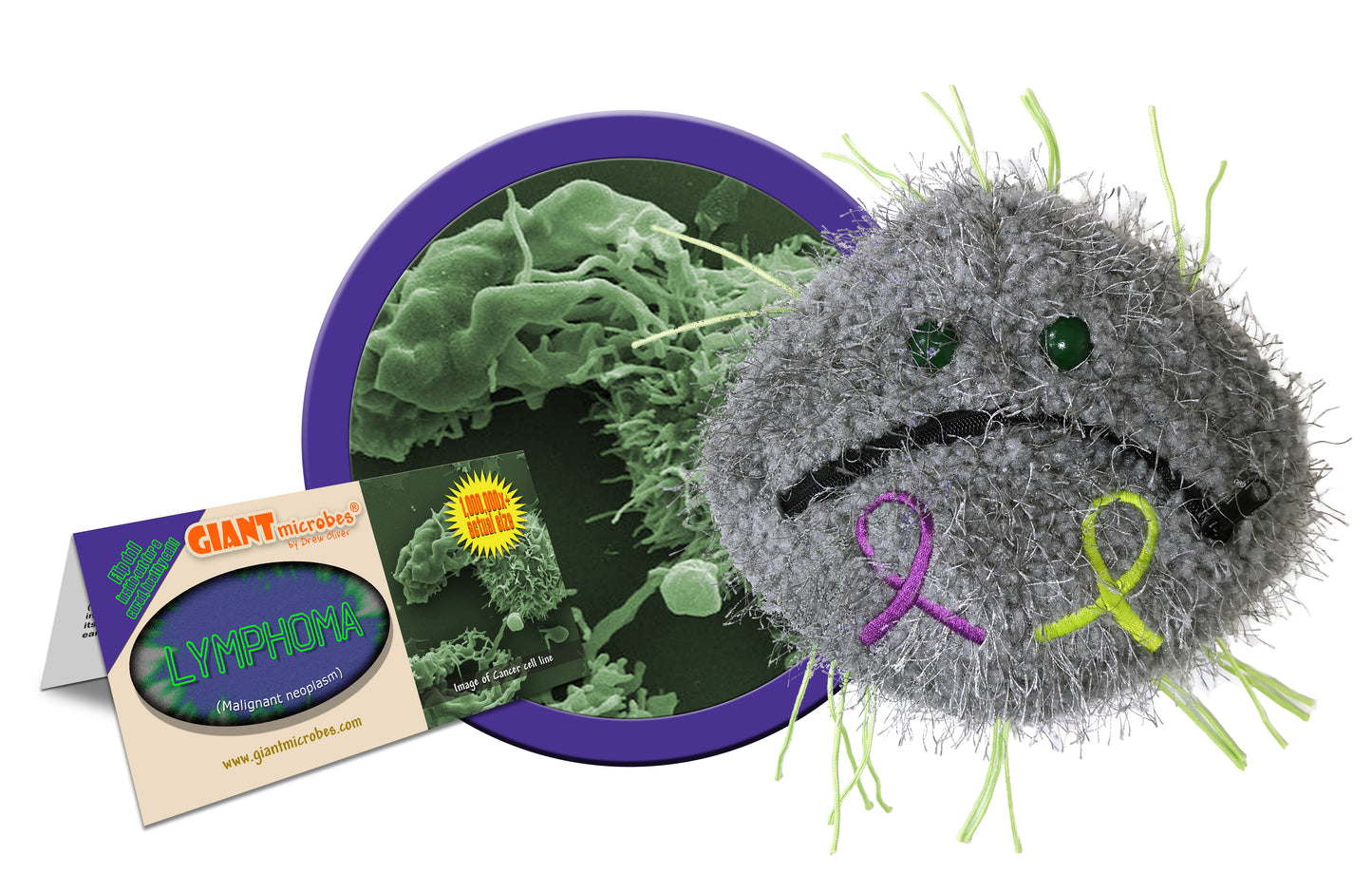 Lymphoma (Malignant Neoplasm)