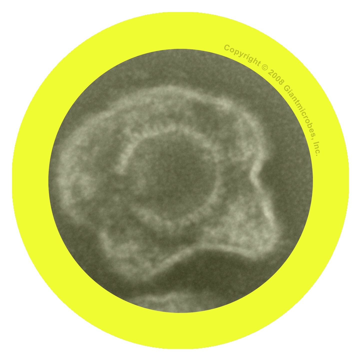 Herpes (Herpes Simplex Virus 2)