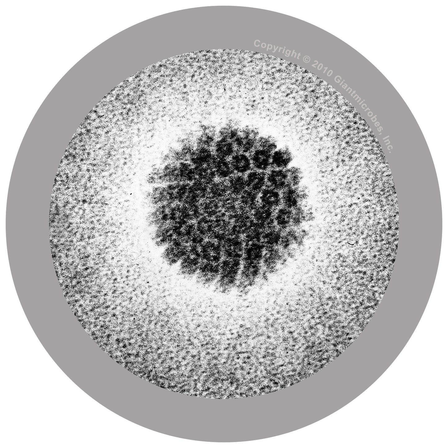 HPV (Human Papillomavirus)