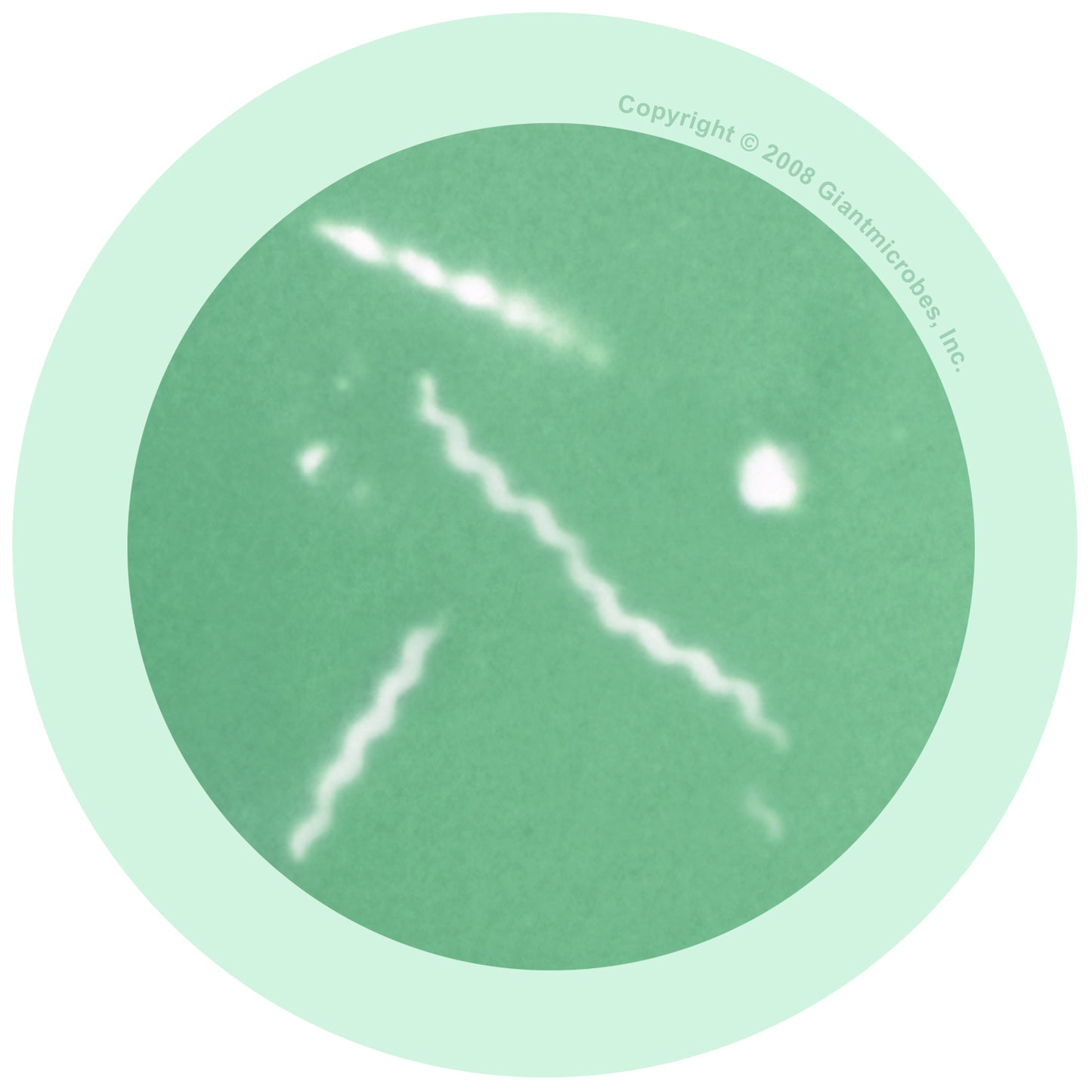 Lyme Disease (Borrelia Burgdorferi)