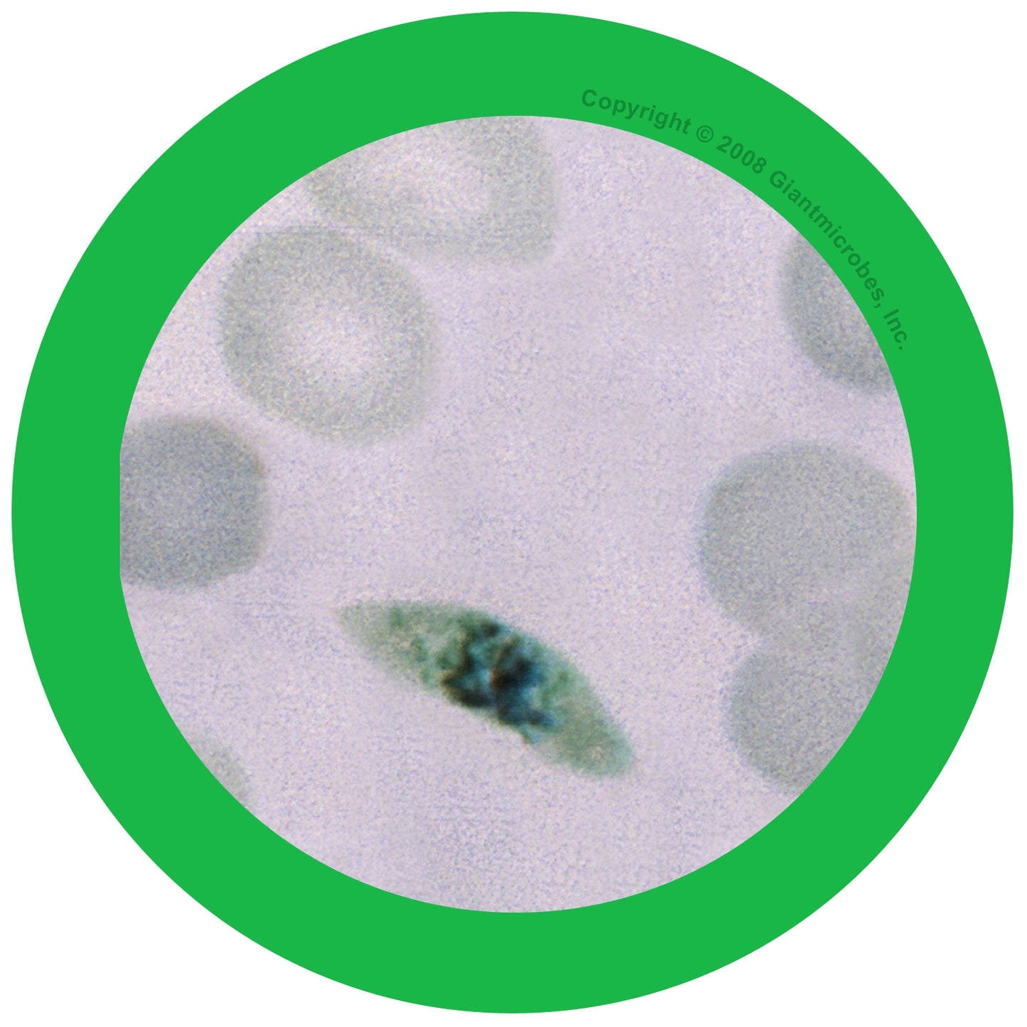 Malaria (Plasmodium Falciparum)