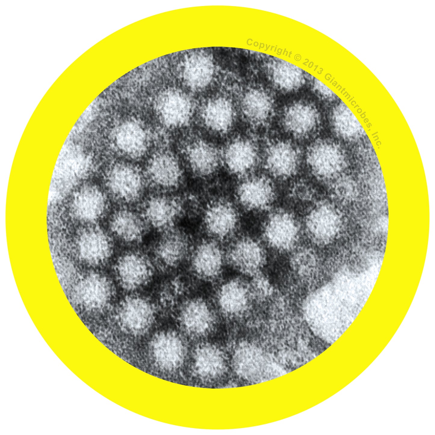 Norovirus (Norovirus)