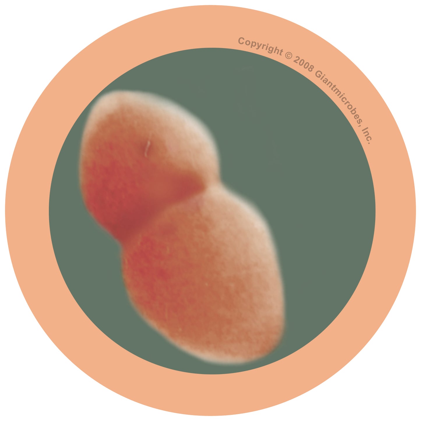 Pneumonia (Streptococcus Pneumonia)