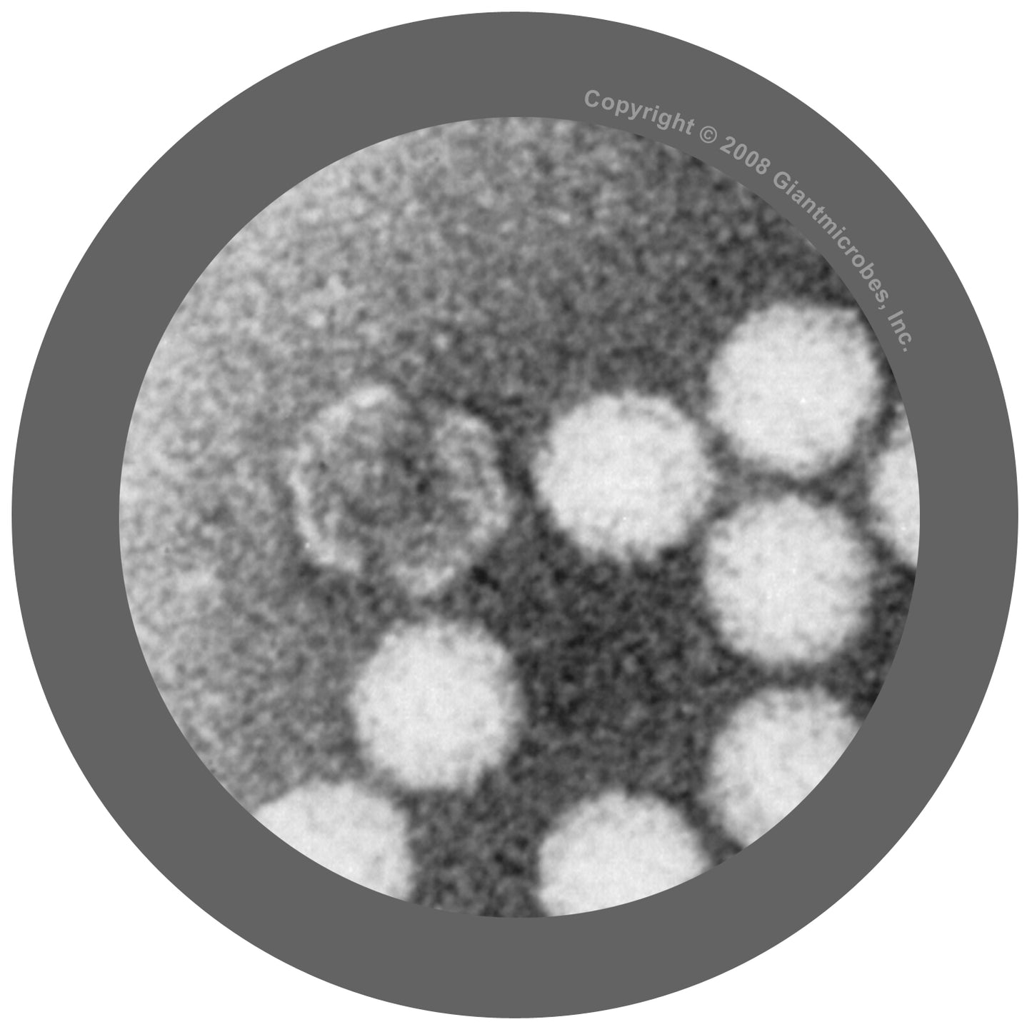Polio