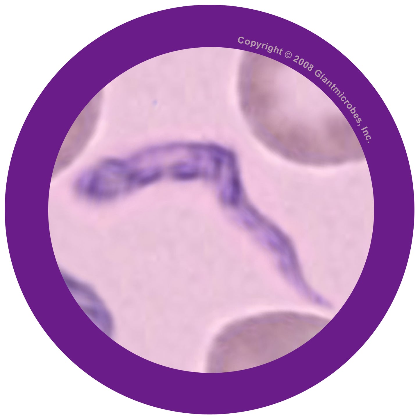 Sleeping Sickness (Trypanosoma Brucei)