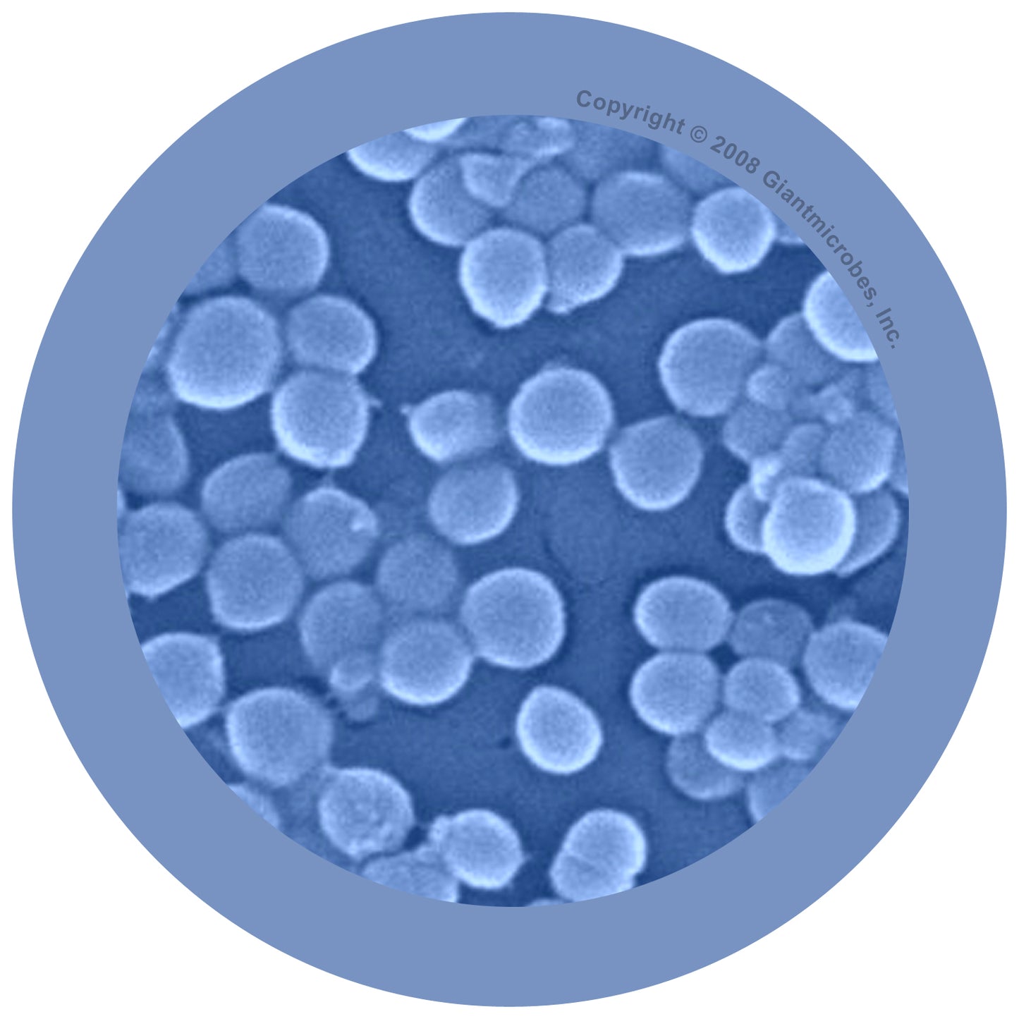 Staph (Staphylococcus Aureus)