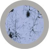 Brain Cell key chain