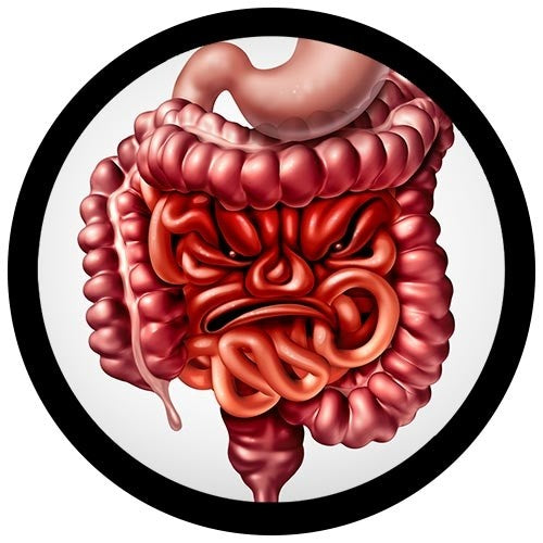 Irritable Bowel Syndrome