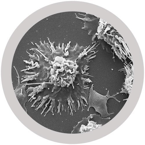 Lung Cancer (Malignant Neoplasm)