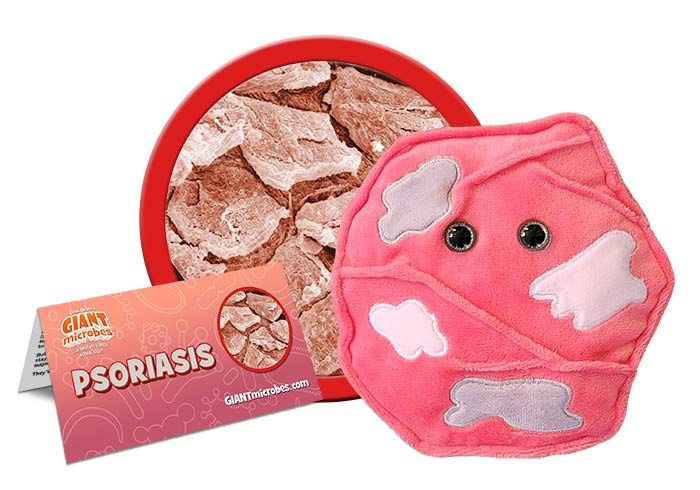 Psoriaisis
