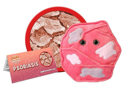 Psoriaisis