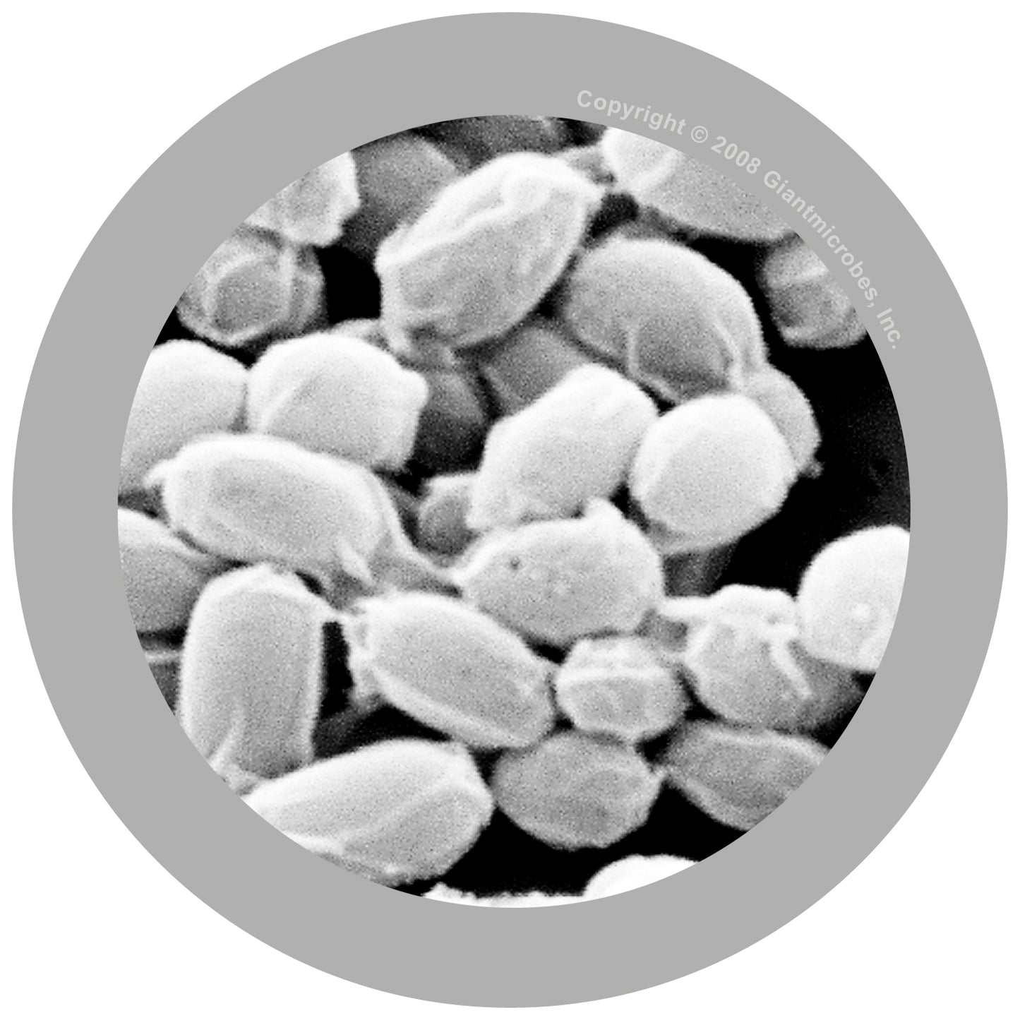 Anthrax (Bacillus Anthracis)