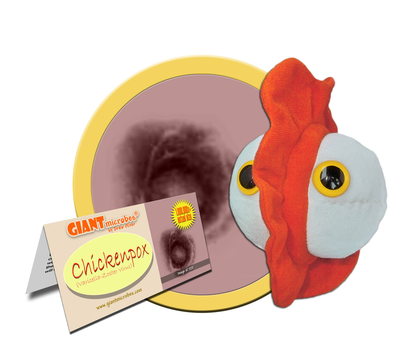 Chicken Pox (Varicella-Zoster Virus)