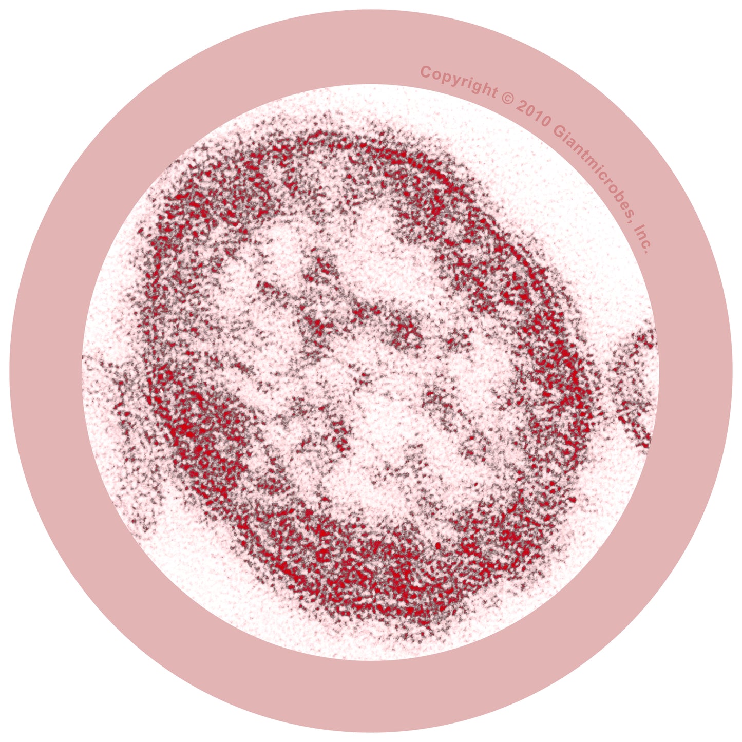 Measles (Morbillivirus)