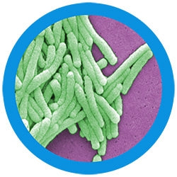Legionnaires' Disease (Legionella Pneumophila)