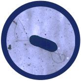 Listeria (Listeria Monocytogenes)