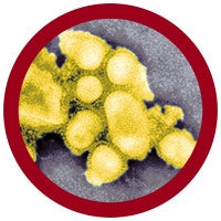 Spanish Flu (Influenza A Virus H1N1)
